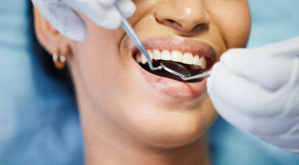 Best Urgent Care for Lost Fillings or Crowns in Avoca, PA